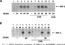 IRF3 protein, human | Semantic Scholar