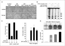 [PDF] Androgenic control of transforming growth factor-beta signaling in prostate epithelial cells through transcriptional... 