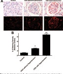 Interleukin 6 Underlies Angiotensin II–Induced Hypertension and Chronic Renal Damage | Semantic Scholar