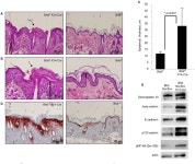 [PDF] Folliculin, the Product of the Birt-Hogg-Dube Tumor Suppressor Gene, Interacts with the Adherens Junction Protein p0071 to... 