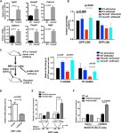 TGF-β Inhibition Rescues Hematopoietic Stem Cell Defects and Bone Marrow Failure in Fanconi Anemia. | Semantic Scholar