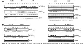 SH2 domain-containing leukocyte protein, 76-kDa | Semantic Scholar
