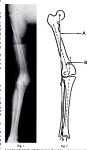 [PDF] Late degenerative changes after meniscectomy. Factors affecting the knee after operation. | Semantic Scholar