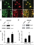 Soluble Nogo Receptor Down-regulates Expression of Neuronal Nogo-A to Enhance Axonal Regeneration* | Semantic Scholar