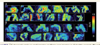 [PDF] Imaging acetylcholinesterase density in peripheral organs in Parkinsons disease with 11C-donepezil PET. | Semantic Scholar
