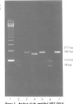 [PDF] dysgenesis . of the SRY gene leads to XY gonadal A new de novo mutation ( A 113 T ) in HMG box | Semantic Scholar