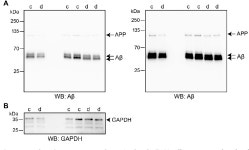 [PDF] Functional Relationships between L1CAM, LC3, ATG12, and Aβ | Semantic Scholar