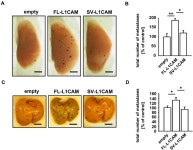 [PDF] Full-Length L1CAM and Not Its Δ2Δ27 Splice Variant Promotes Metastasis through Induction of Gelatinase Expression... 