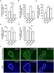 [PDF] Full-Length L1CAM and Not Its Δ2Δ27 Splice Variant Promotes Metastasis through Induction of Gelatinase Expression... 