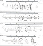 Table 5.9 from Application of autosomal INDELs as a forensic tool in Qatar | Semantic Scholar