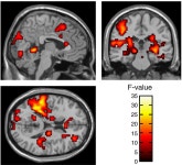 The neural mechanisms of semantic and response conflicts: An fMRI study of practice-related effects in the Stroop task | Semantic... 
