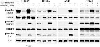 Gefitinib Induces Apoptosis in the EGFRL858R Non–Small-Cell Lung Cancer Cell Line H3255 | Semantic Scholar