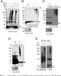 [PDF] Tissue transglutaminase-induced aggregation of α-synuclein: Implications for Lewy body formation in Parkinsons disease... 