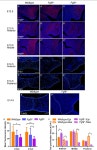 The Fibroblast Growth Factor 9 (Fgf9) Participates in Palatogenesis by Promoting Palatal Growth and Elevation | Semantic Scholar