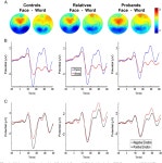 [PDF] The face and its emotion: Right N170 deficits in structural processing and early emotional discrimination in schizophrenic... 