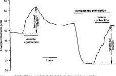 Regulation of Skeletal Muscle Blood Flow During Contractions | Semantic Scholar