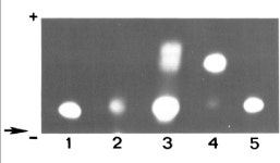 Chronic GM2 gangliosidosis masquerading as atypical Friedreich ataxia | Semantic Scholar
