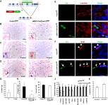 [PDF] Postnatal Ablation of Foxm1 from Cardiomyocytes Causes Late Onset Cardiac Hypertrophy and Fibrosis without Exacerbating... 
