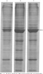 Lens Diseases | Semantic Scholar