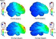 P096 COMETS2: A MATLAB toolbox for numerical simulation of electric fields generated by transcranial direct current stimulation... 
