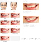 밝은 미소 갖기 위한 세번째 조건, “깨끗한 잇몸과 스마일라인” - 뉴스와이어