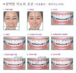 매직키스치과, 완벽한 미소 만드는 ‘스마일라인(Smile Line)’ - 뉴스와이어