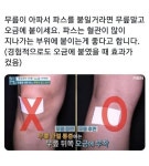무릎 통증으로 파스 붙일때 꿀팁 | 보배드림 자유게시판