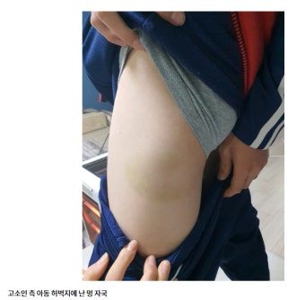 '손웅정 감독 아동학대 혐의 피소' | 보배드림 자유게시판