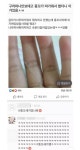 똥꼬가 따가워서 만졌더니 나왔던 물건 . jpg | 보배드림 자유게시판