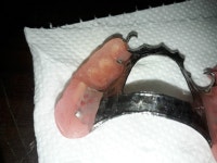 치과나 치과기공 쪽에서 일하시는 분 계신가요? (틀니사진 혐) | 보배드림 자유게시판