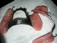 치과나 치과기공 쪽에서 일하시는 분 계신가요? (틀니사진 혐) | 보배드림 자유게시판