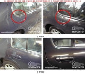 덴트닥터 과거작업사진모음1-2 | 보배드림 장착시공사진