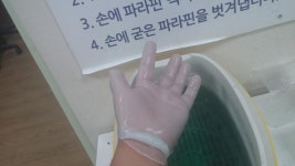악혐 물리치료 중입니다 | 보배드림 국산차게시판 악혐     물리치료 중입니다 | 보배드림 국산차게시판