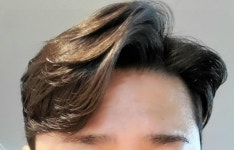 크뤼님 모발 상태가 궁금하네요 | 보배드림 국산차게시판