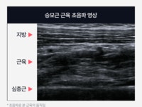마이트렉스 DR.HEAT NECK 닥터 히트넥 360도 EMS 온열 목 마사지기 마이트렉스 DR.HEAT NECK 닥터 히트넥  360도 EMS 온열 목 마사지기