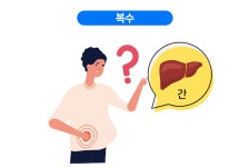 복수 [Ascites] | 건강정보