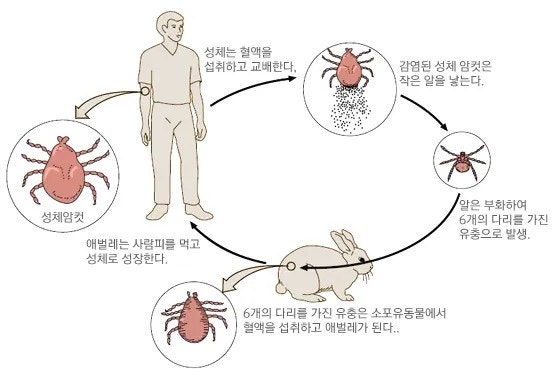 러시아 발진티푸스: 숨겨진 역사와 최신 연구 동향 2 발진 티푸스
