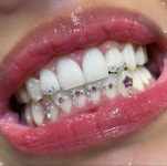 투스젬 • 𝖙𝖔𝖔𝖙𝖍 𝖋𝖆𝖎𝖗𝖞 ✩⡱ on Instagram: 다이아& 핑크로 포인트 💗 done at @thelinemarket_seoul... 