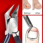 말린발톱 한번에 두발케어?[ENG SUB]Its both feet this time! Care for both dried nails at once - YouTube | 패디큐어, 창조적인, 좋은... 