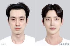 디에이성형외과