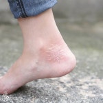 한여름의 눈꽃송이❄ Snow crystal in summer #타투 #타투이스트 #흰색타투 #눈꽃 #눈꽃타투 #아로새기다 #아낙림 #tattoo... 