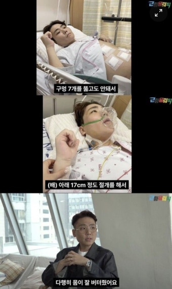 '괴사성 췌장염' 송필근 