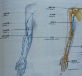 우측 상지로부터 배출되는 정맥