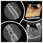 Tomografias에 있는 Odontoradio님의 핀 | 치과