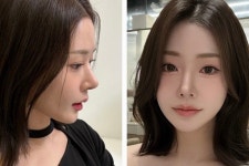 오엠성형외과의원