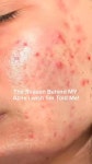 your skin problems! The Reason of many skin problems and... Damaged Skin Barrier Unfortunately, most people including i,we forget... 