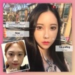 Before and after에 있는 핀