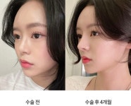 오엠성형외과의원