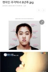 렛미인 주걱턱녀 8년후