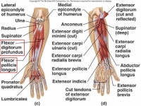 깊은손가락굽힘근(심지굴근) Flexor digitorum profundus 18 긴엄지굽힘근(장무지굴근) Flexor pollicis longus 19 네모엎침근... 